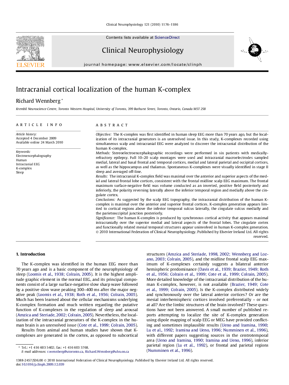 Intracranial cortical localization of the human K-complex