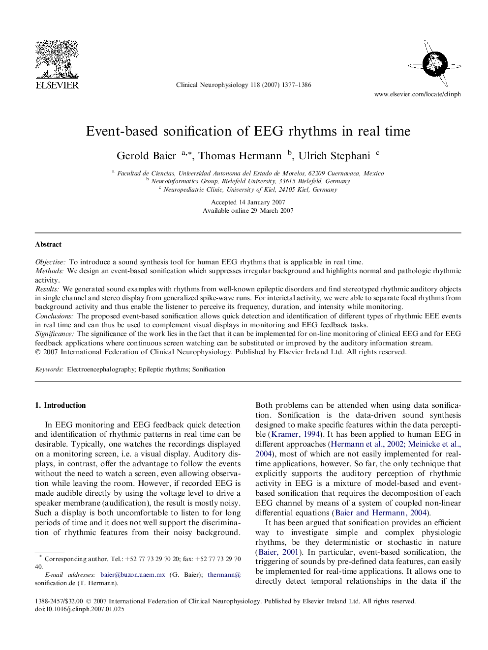 Event-based sonification of EEG rhythms in real time