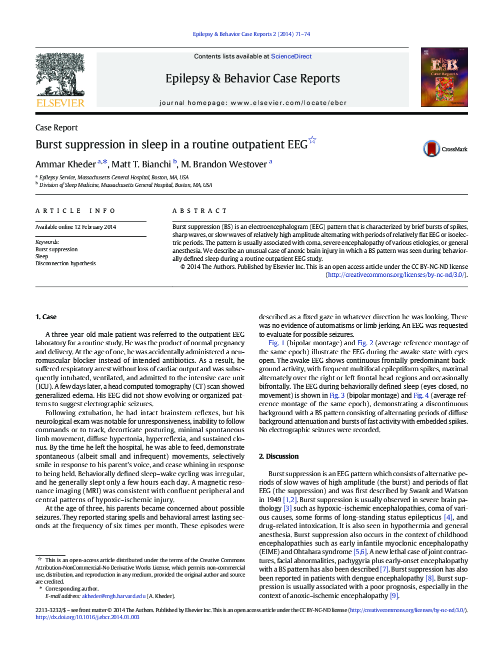 Burst suppression in sleep in a routine outpatient EEG 