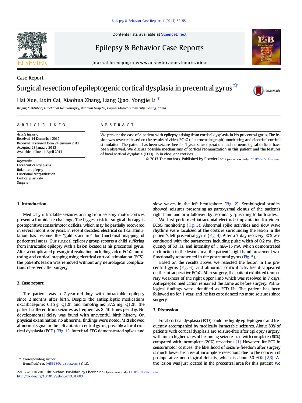 عکس صفحه اول مقاله: Surgical resection of epileptogenic cortical dysplasia in precentral gyrus Surgical resection of epileptogenic cortical dysplasia in precentral gyrus