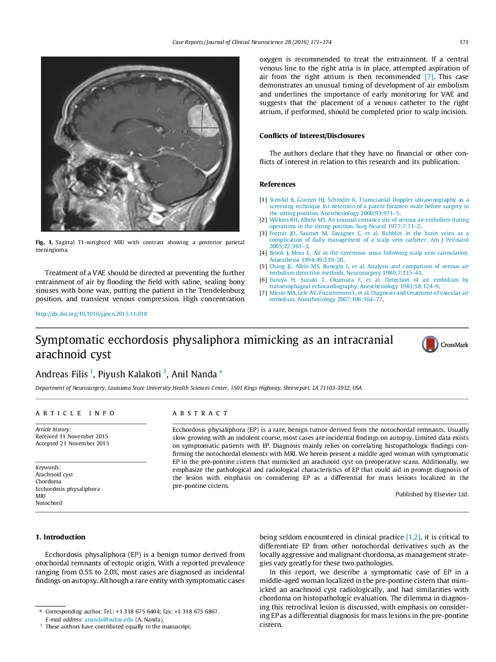 Symptomatic ecchordosis physaliphora mimicking as an intracranial arachnoid cyst