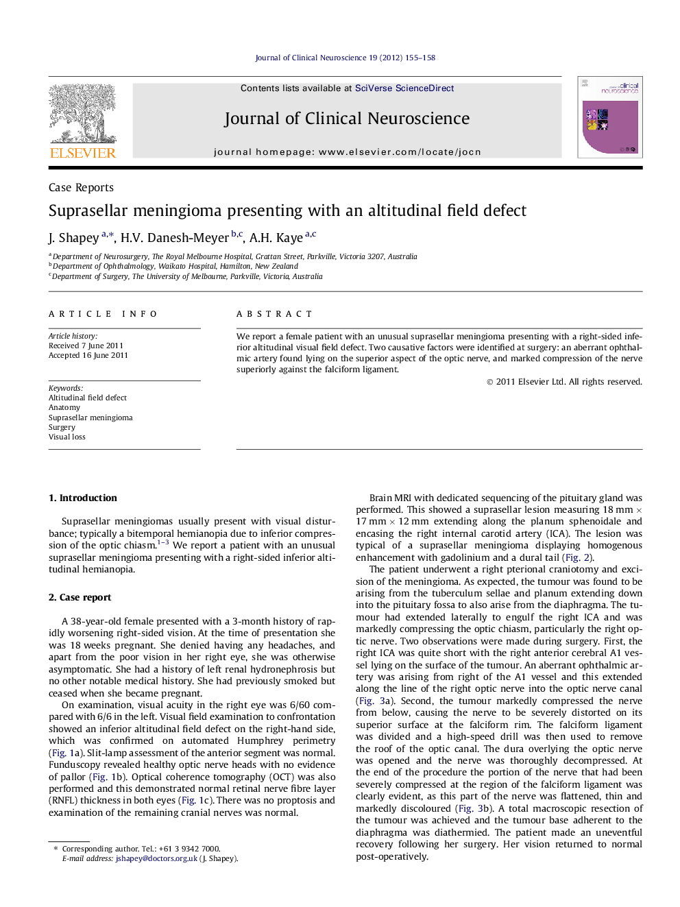 Suprasellar meningioma presenting with an altitudinal field defect