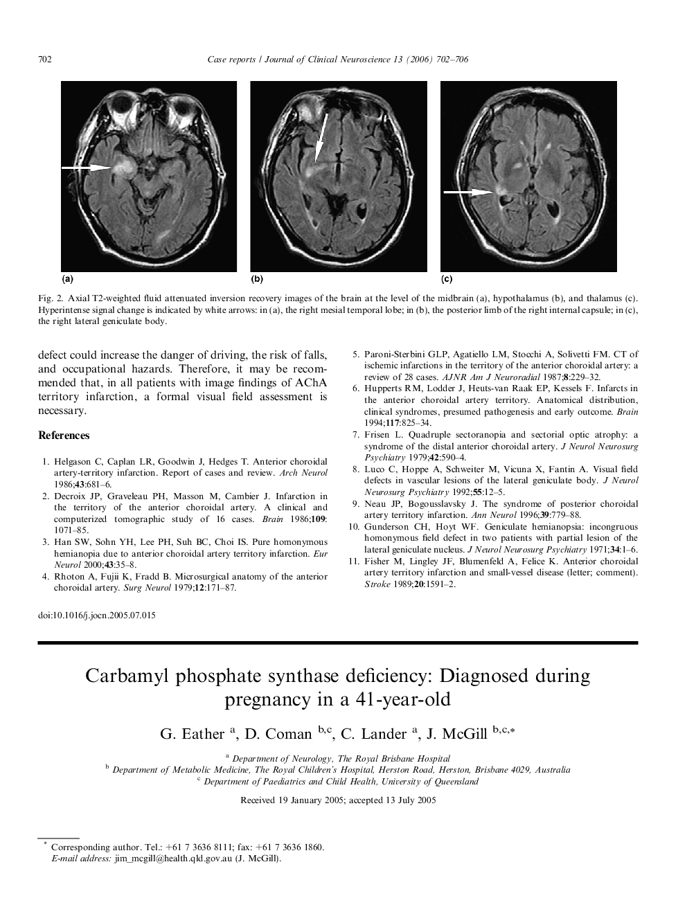 Carbamyl phosphate synthase deficiency: Diagnosed during pregnancy in a 41-year-old