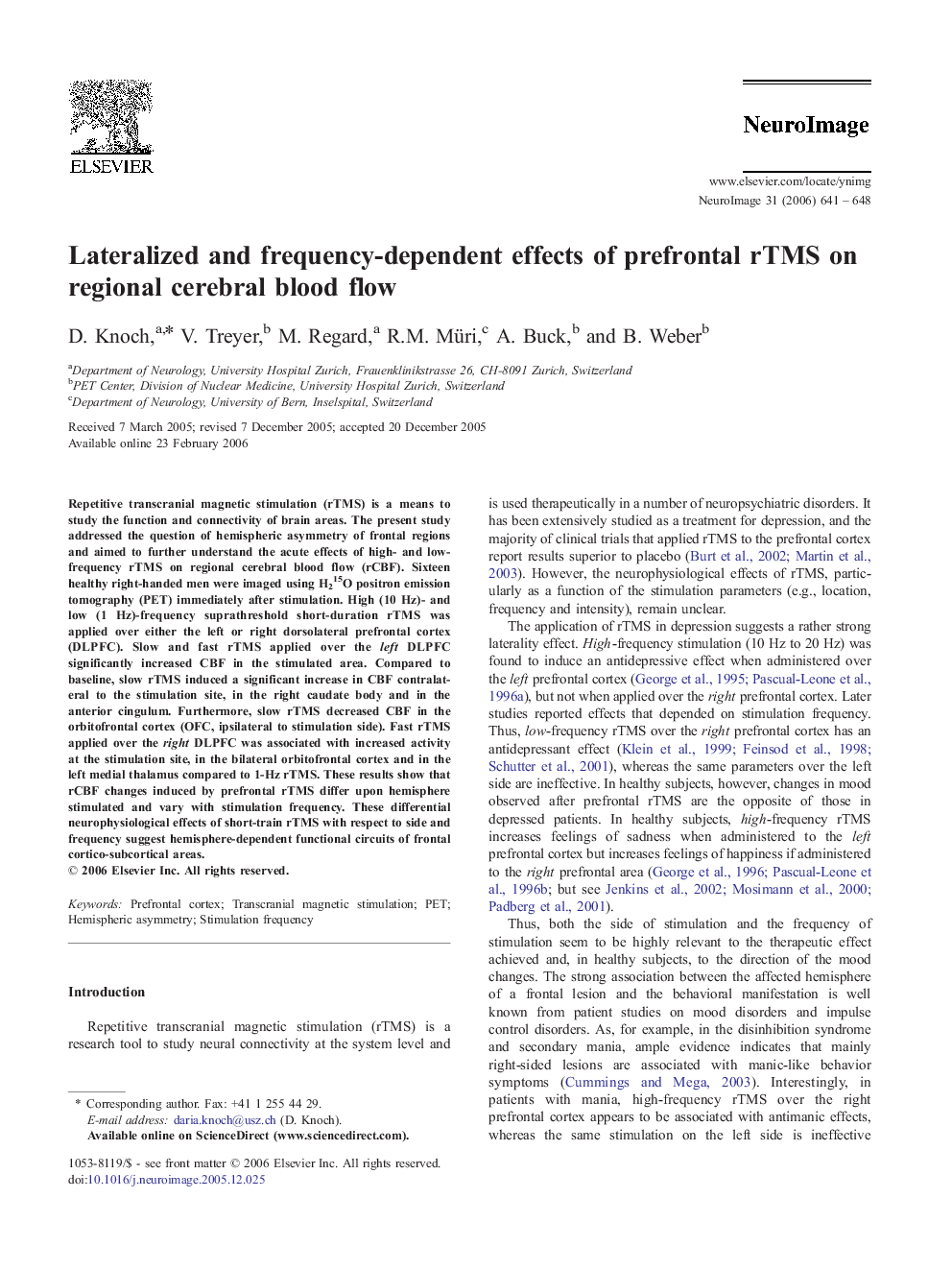 Lateralized and frequency-dependent effects of prefrontal rTMS on regional cerebral blood flow