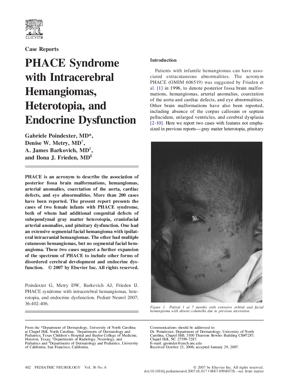 PHACE Syndrome with Intracerebral Hemangiomas, Heterotopia, and Endocrine Dysfunction