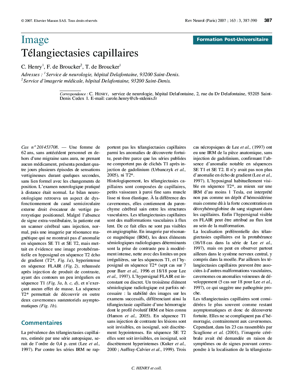 Télangiectasies capillaires