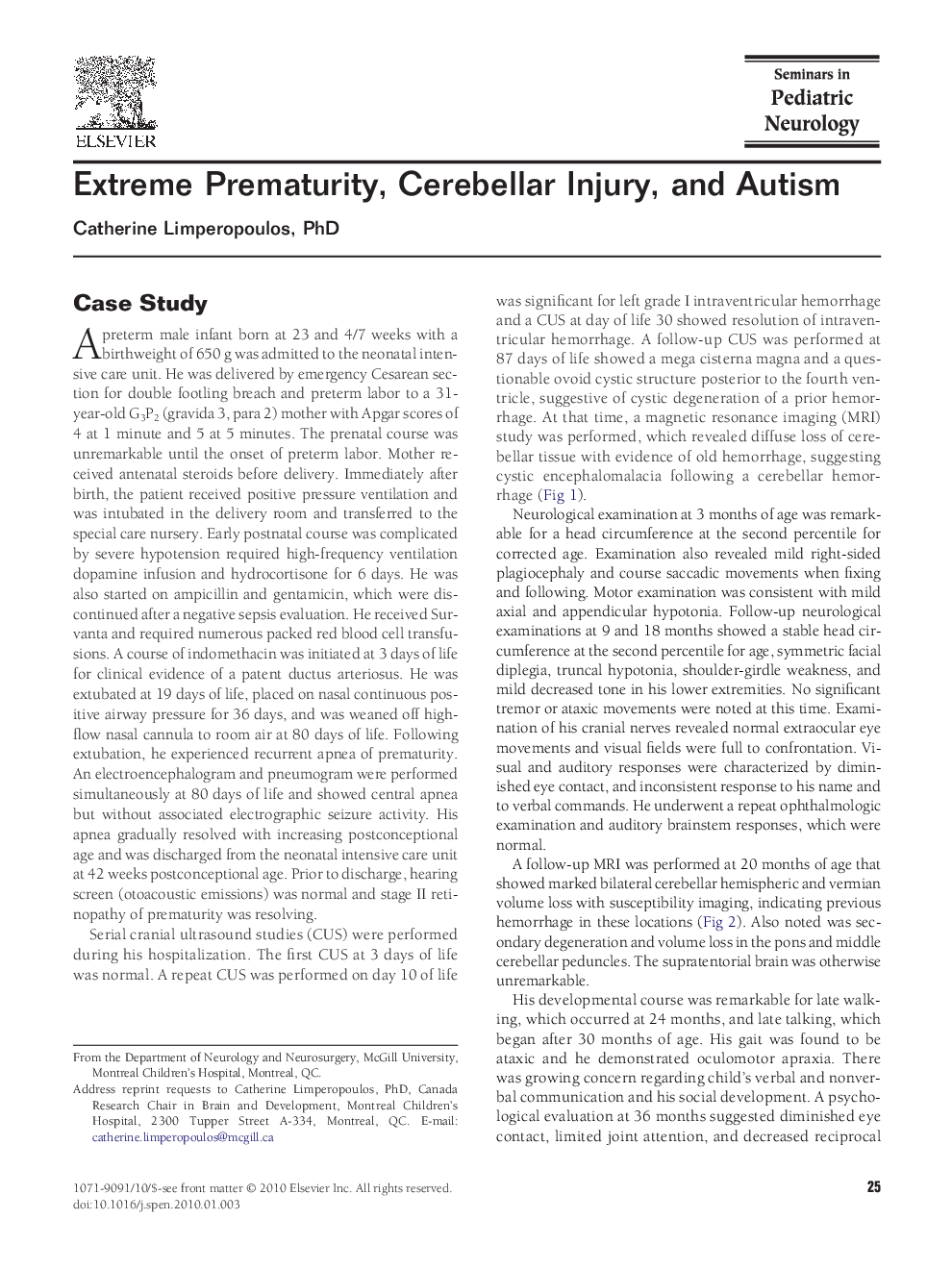 Extreme Prematurity, Cerebellar Injury, and Autism