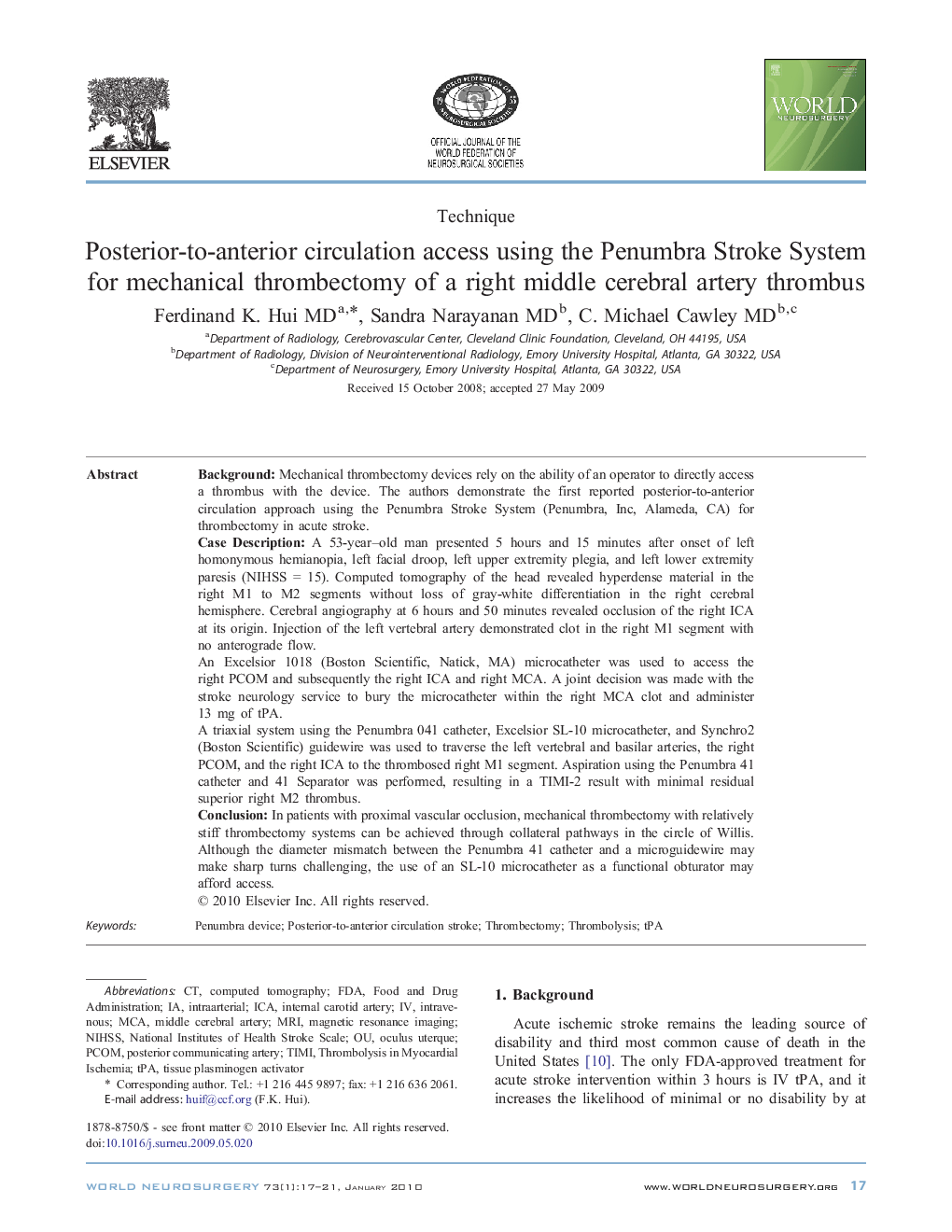 Posterior-to-anterior circulation access using the Penumbra Stroke System for mechanical thrombectomy of a right middle cerebral artery thrombus