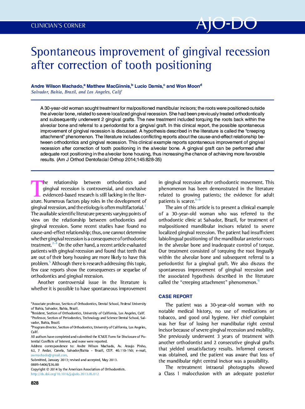 Spontaneous improvement of gingival recession after correction of tooth positioning 