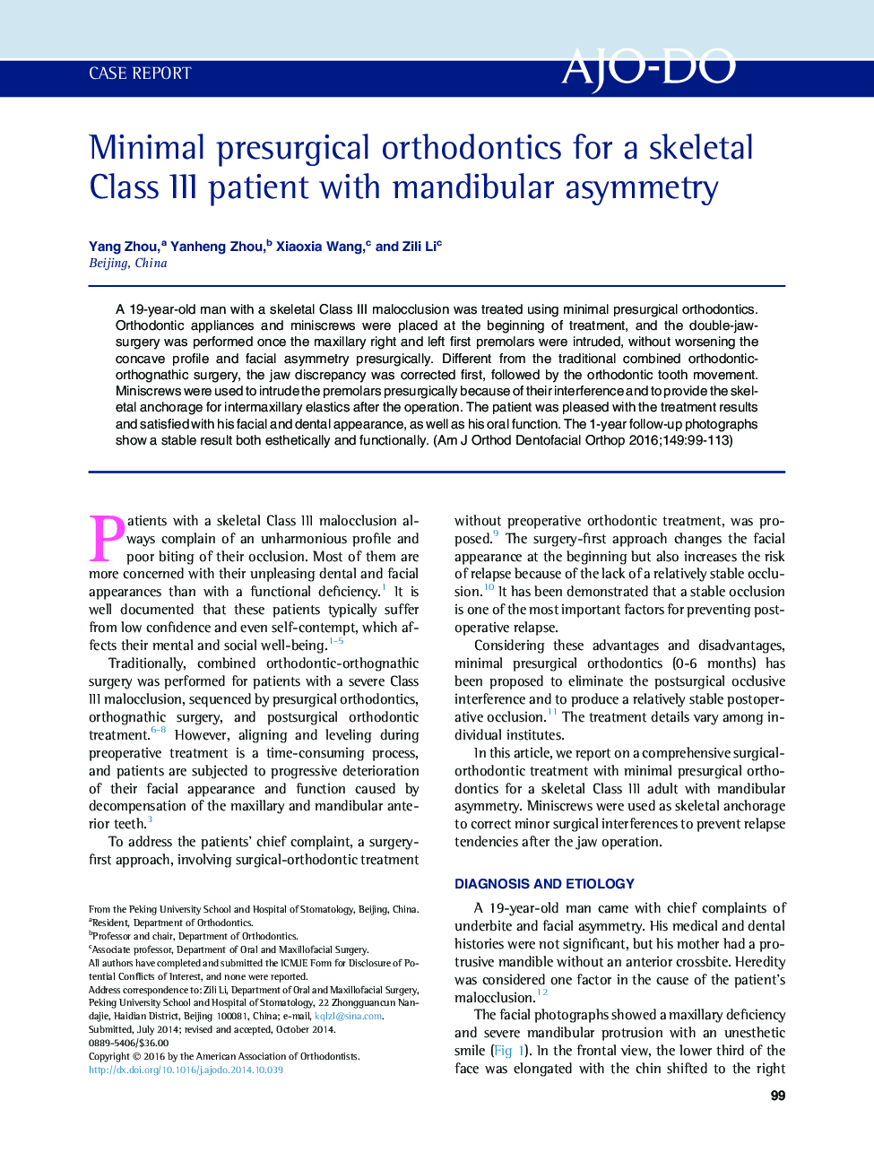 Minimal presurgical orthodontics for a skeletal Class III patient with mandibular asymmetry 