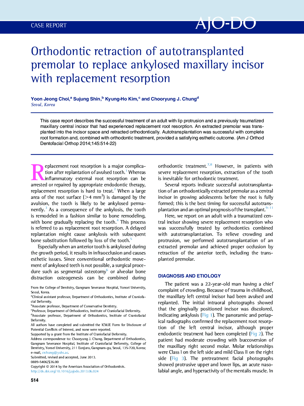 Orthodontic retraction of autotransplanted premolar to replace ankylosed maxillary incisor with replacement resorption 