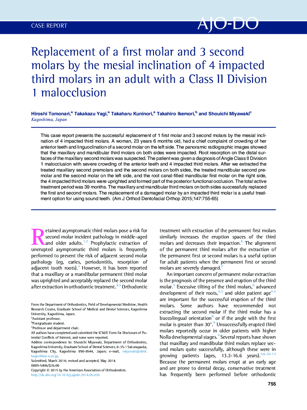 Replacement of a first molar and 3 second molars by the mesial inclination of 4 impacted third molars in an adult with a Class II Division 1 malocclusion 