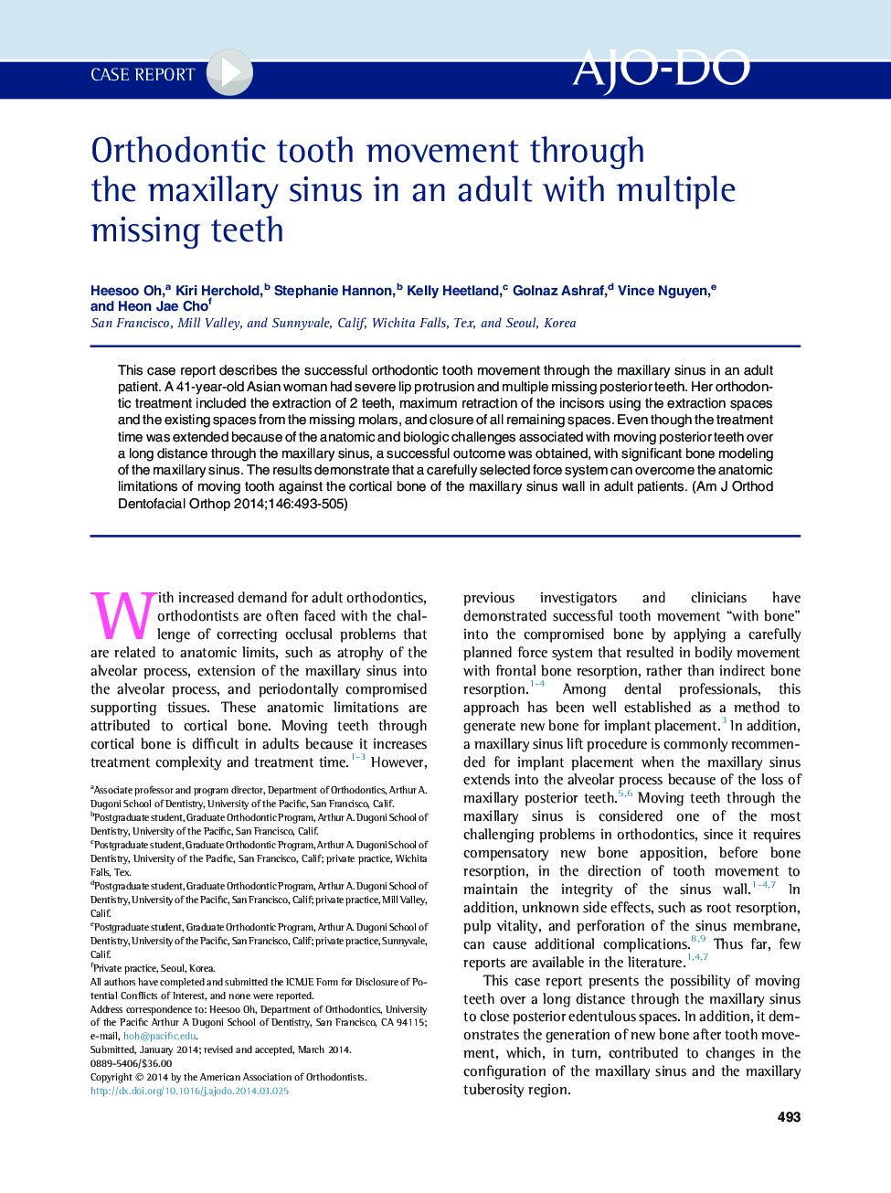 Orthodontic tooth movement through the maxillary sinus in an adult with multiple missing teeth 
