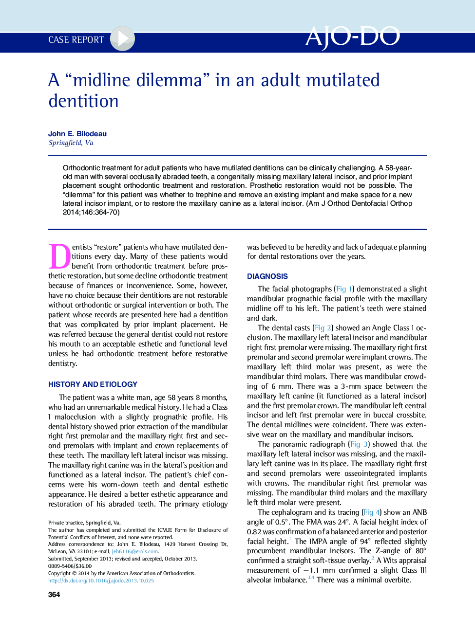 A “midline dilemma” in an adult mutilated dentition 