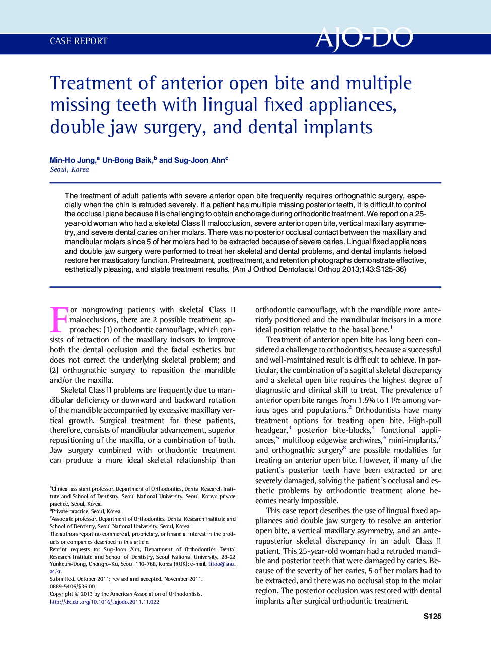 Treatment of anterior open bite and multiple missing teeth with lingual fixed appliances, double jaw surgery, and dental implants 