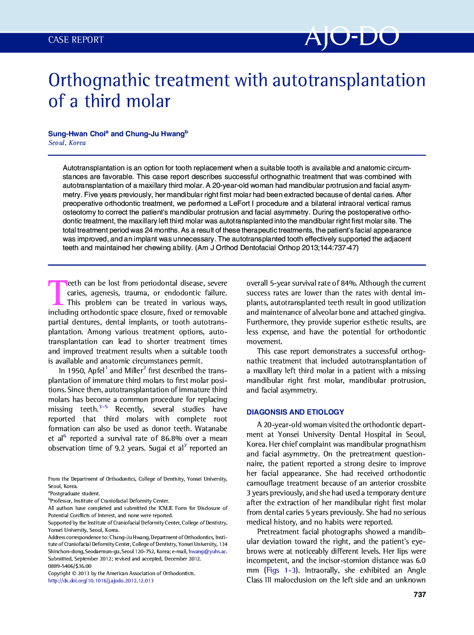 Orthognathic treatment with autotransplantation of a third molar 