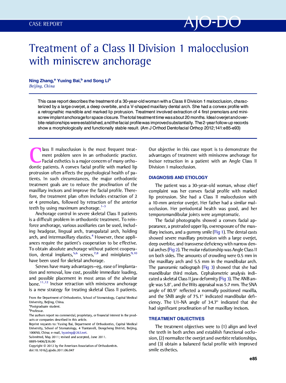 Treatment of a Class II Division 1 malocclusion with miniscrew anchorage 