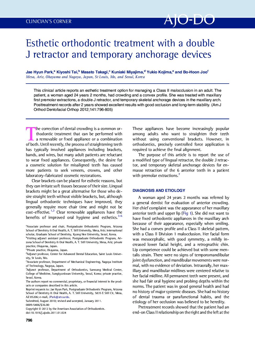 Esthetic orthodontic treatment with a double JÂ retractor and temporary anchorage devices