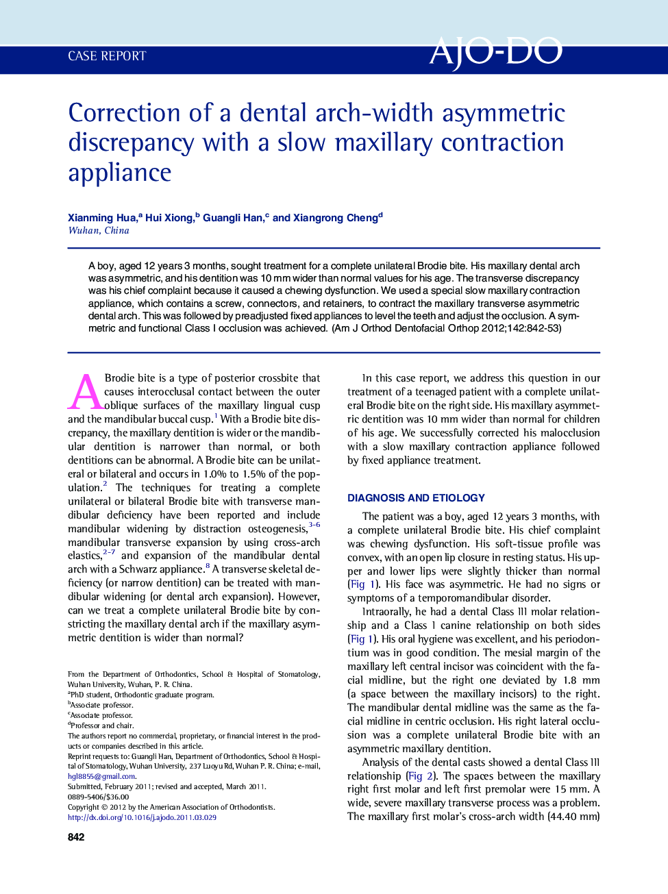 Correction of a dental arch-width asymmetric discrepancy with a slow maxillary contraction appliance 