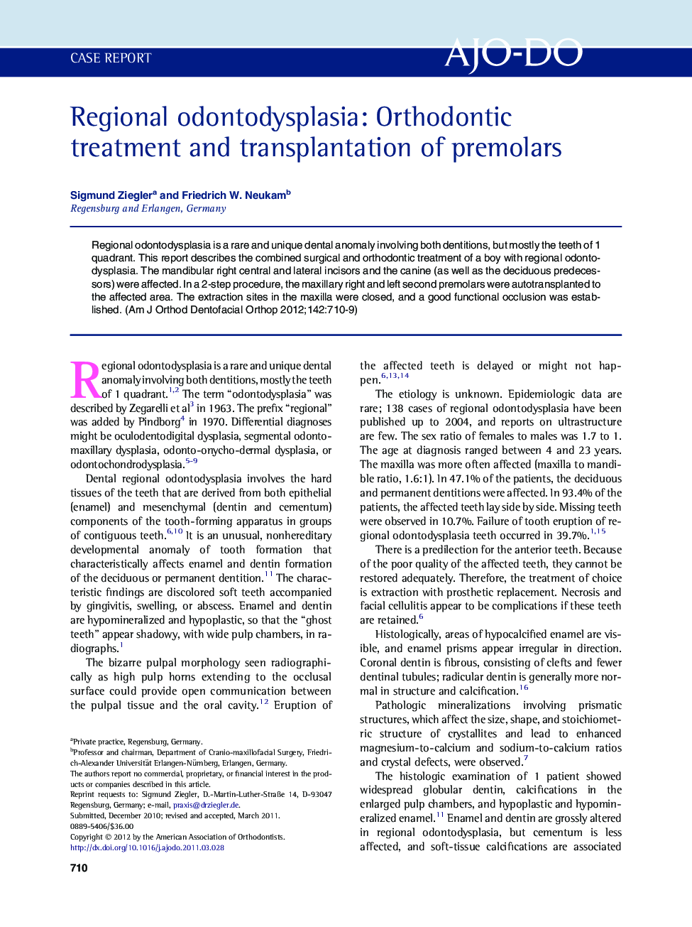 Regional odontodysplasia: Orthodontic treatment and transplantation of premolars 