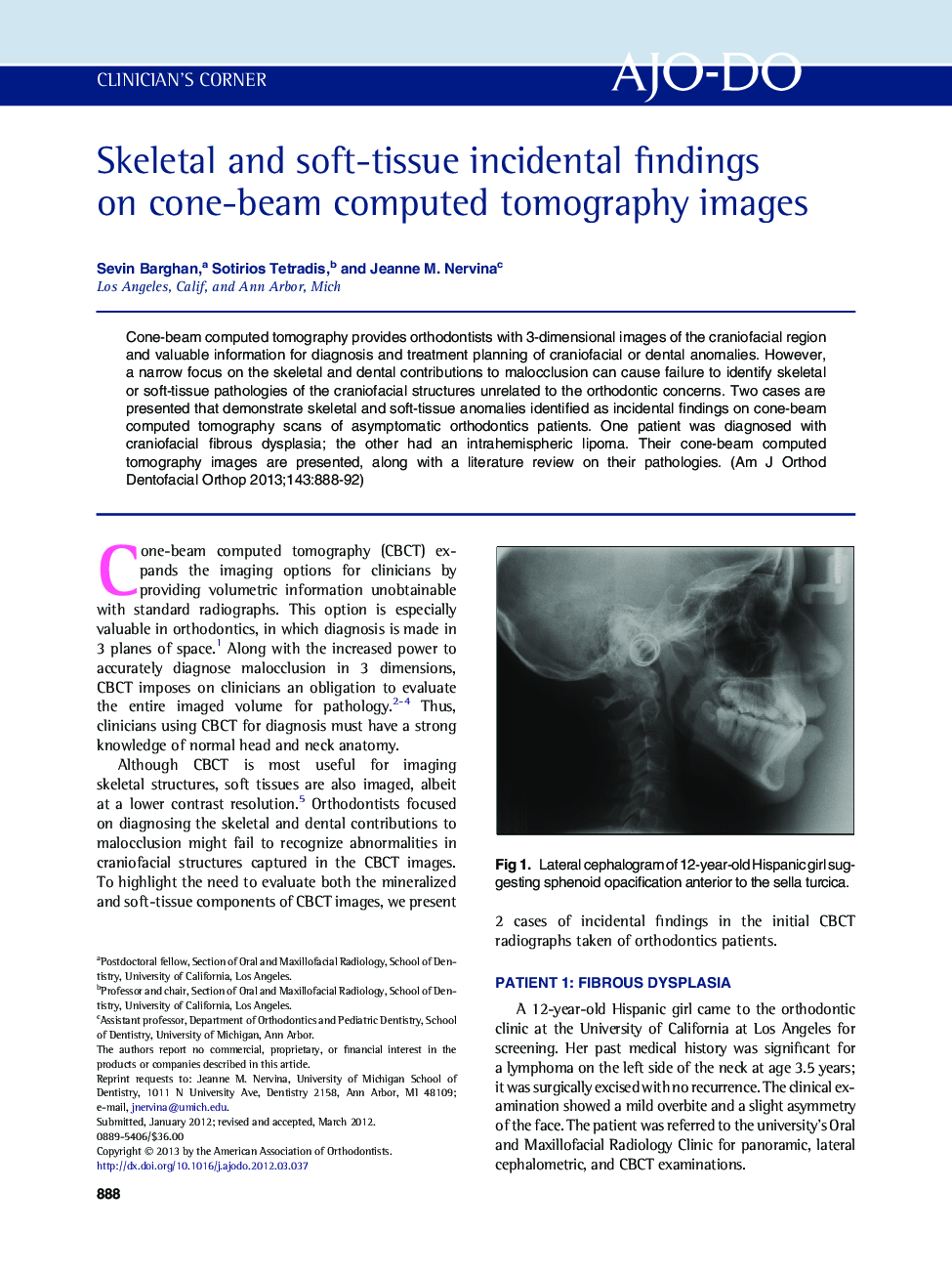 Skeletal and soft-tissue incidental findings on cone-beam computed tomography images 