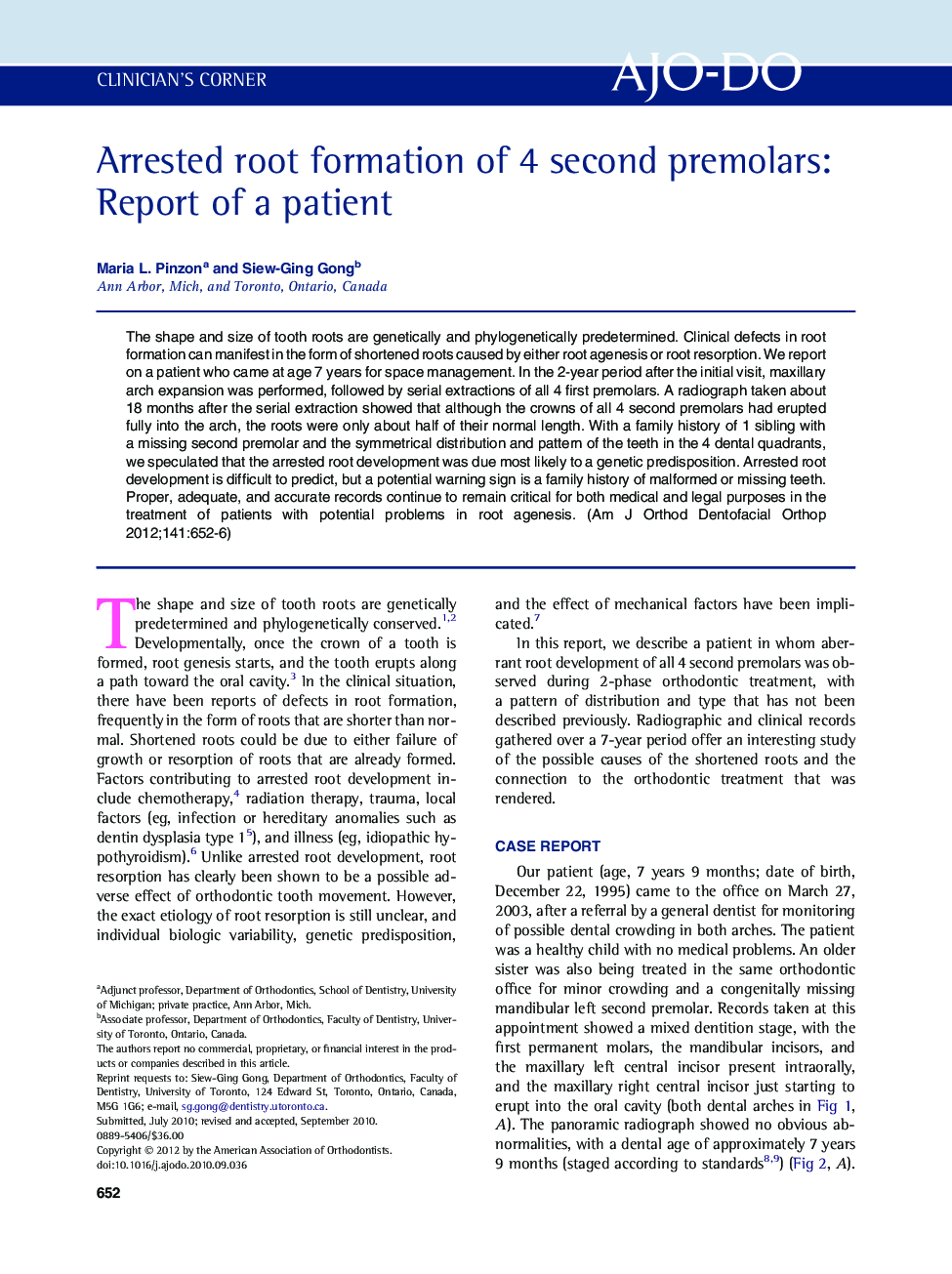 Arrested root formation of 4 second premolars: Report of a patient 