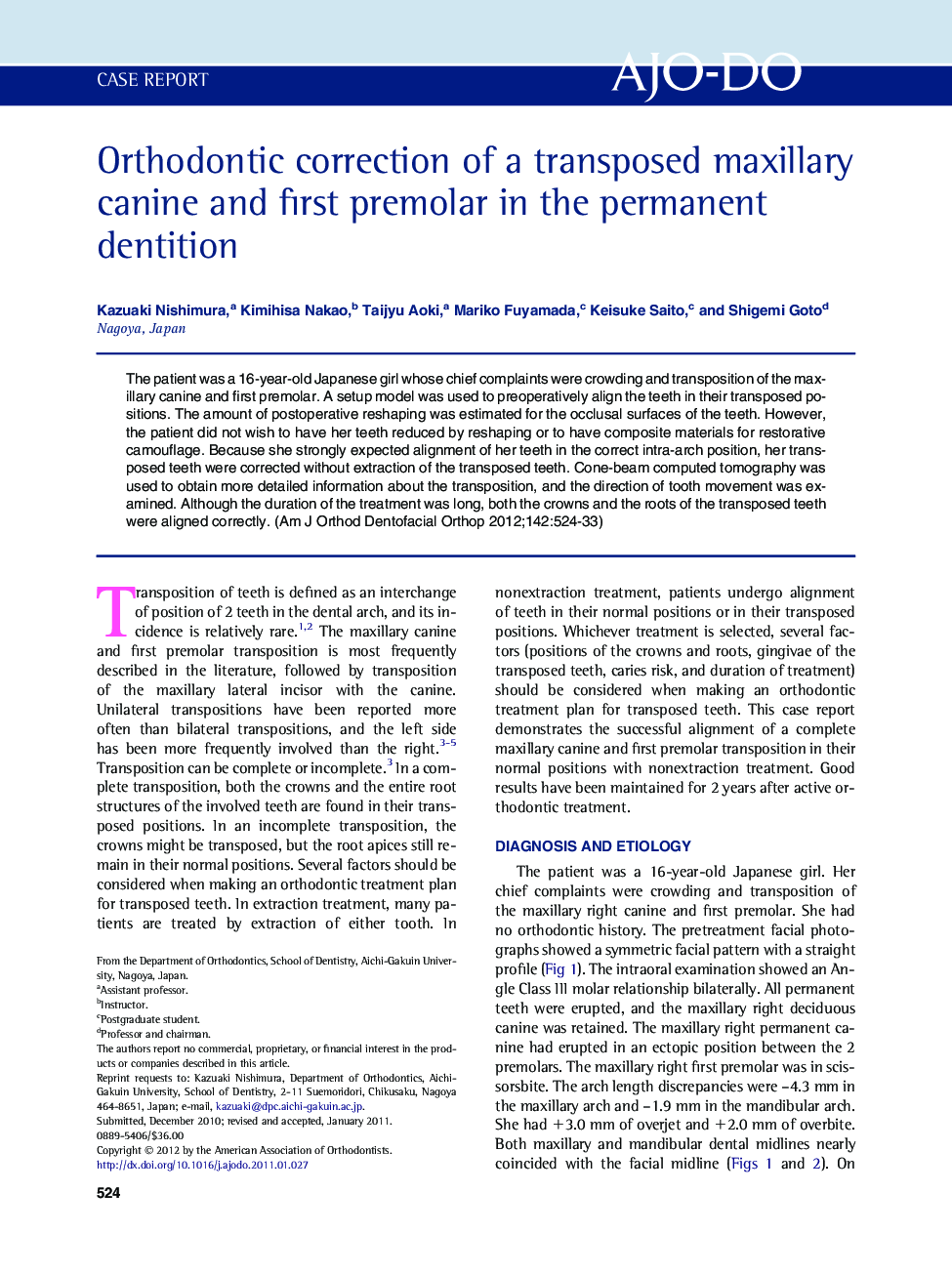 Orthodontic correction of a transposed maxillary canine and first premolar in the permanent dentition 