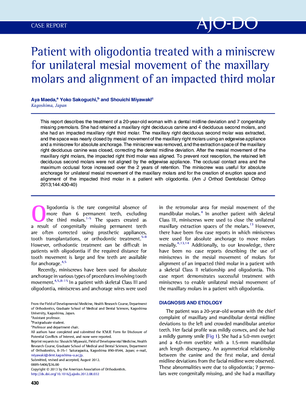 Patient with oligodontia treated with a miniscrew for unilateral mesial movement of the maxillary molars and alignment of an impacted third molar 