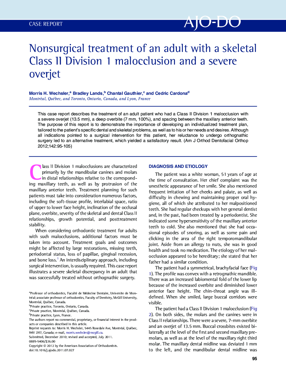 Nonsurgical treatment of an adult with a skeletal Class II Division 1 malocclusion and a severe overjet 