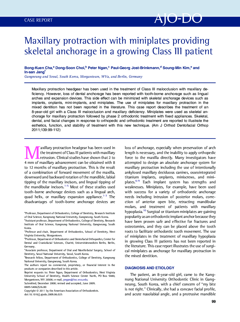 Maxillary protraction with miniplates providing skeletal anchorage in a growing Class III patient 