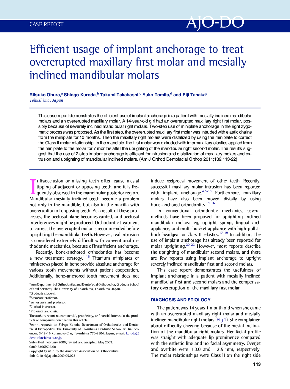 Efficient usage of implant anchorage to treat overerupted maxillary first molar and mesially inclined mandibular molars 