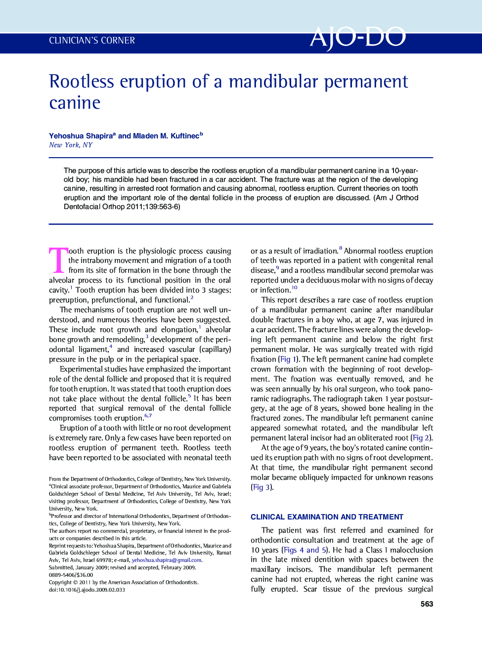 Rootless eruption of a mandibular permanent canine 