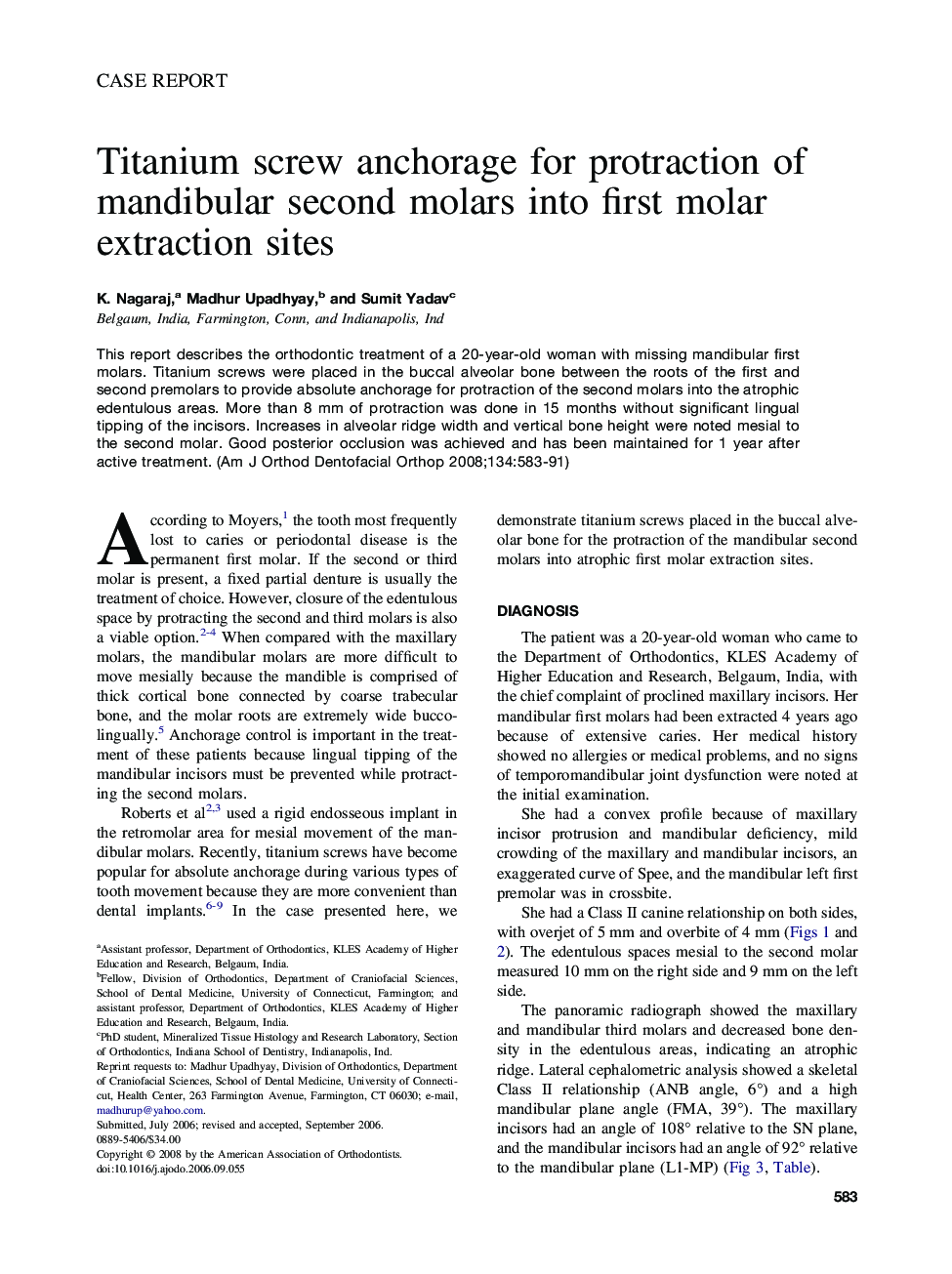 Titanium screw anchorage for protraction of mandibular second molars into first molar extraction sites