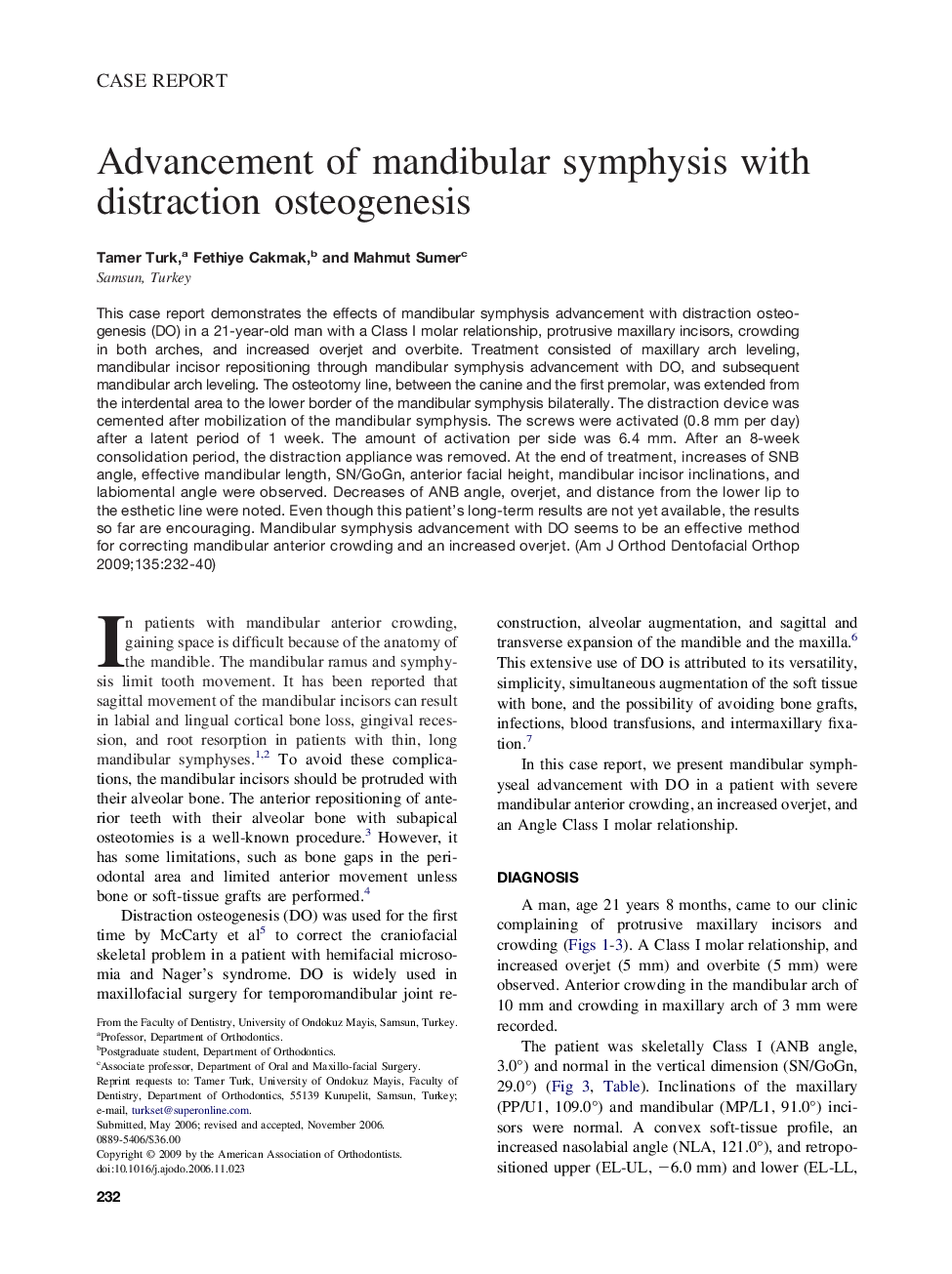 Advancement of mandibular symphysis with distraction osteogenesis