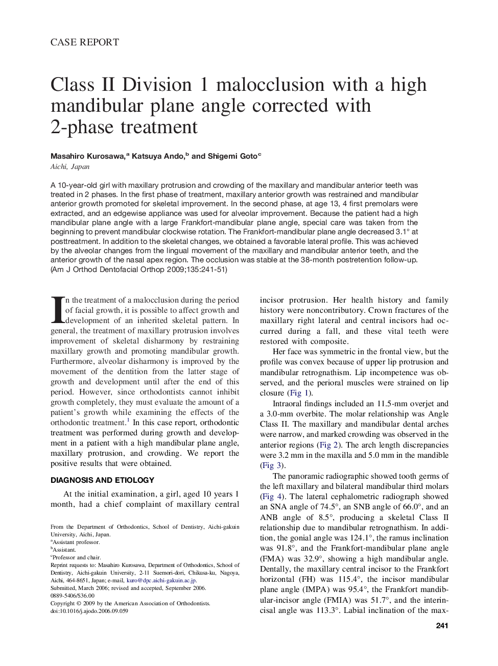 Class II Division 1 malocclusion with a high mandibular plane angle corrected with 2-phase treatment