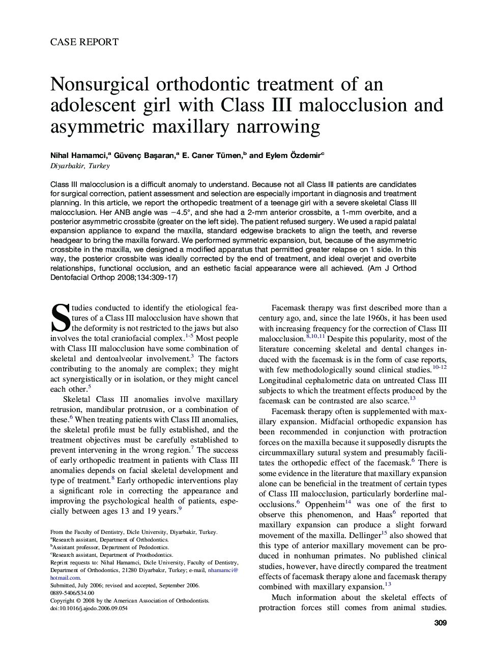 Nonsurgical orthodontic treatment of an adolescent girl with Class III malocclusion and asymmetric maxillary narrowing