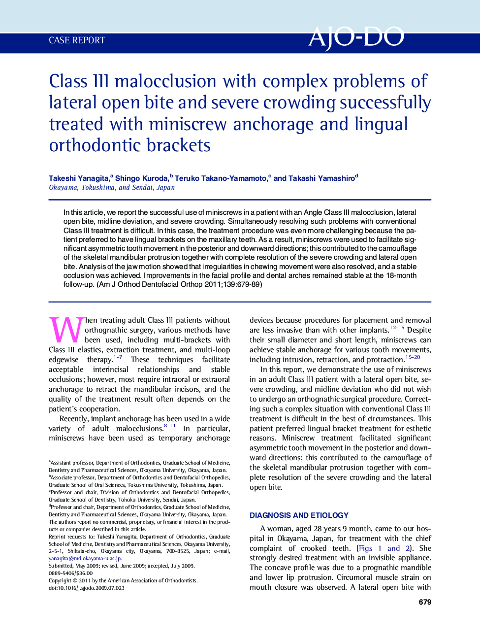 Class III malocclusion with complex problems of lateral open bite and severe crowding successfully treated with miniscrew anchorage and lingual orthodontic brackets 