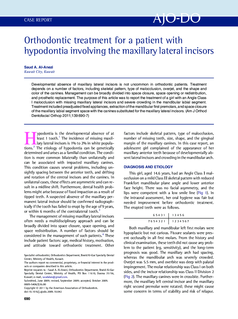 Orthodontic treatment for a patient with hypodontia involving the maxillary lateral incisors 