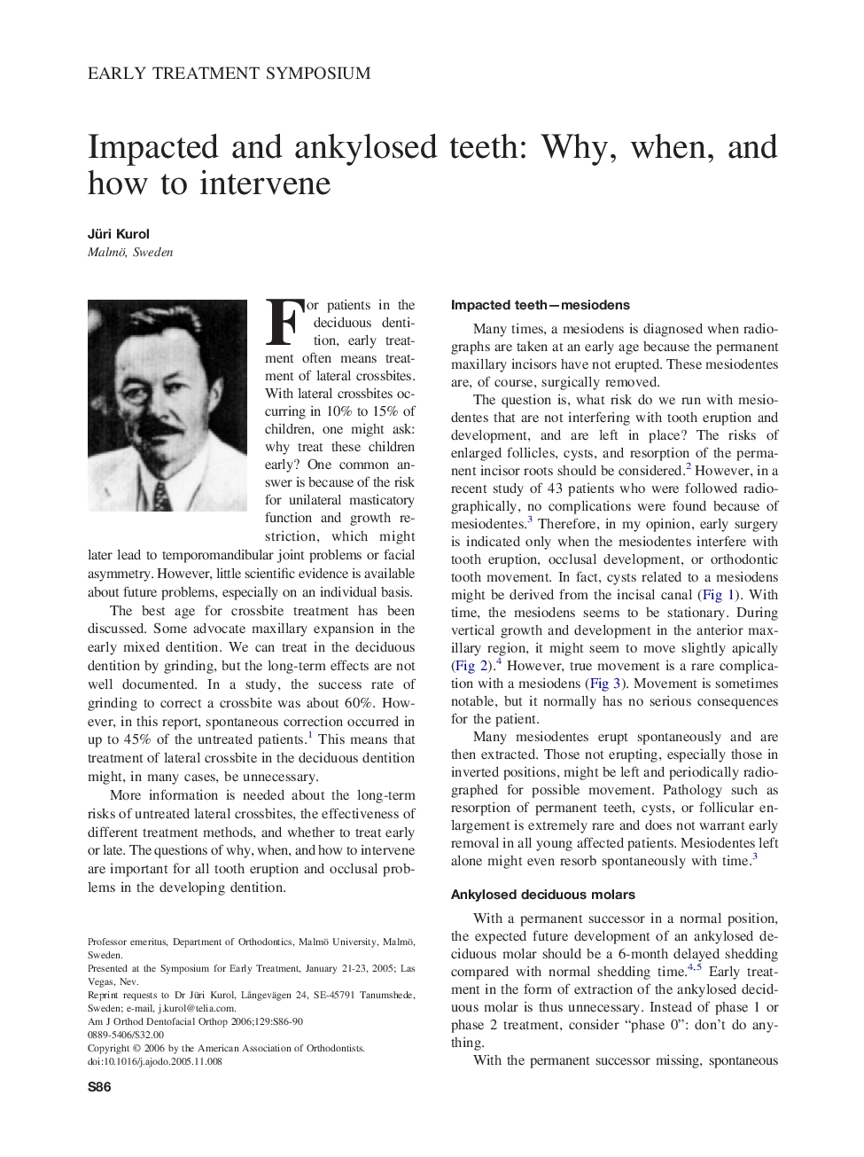 Impacted and ankylosed teeth: Why, when, and how to intervene