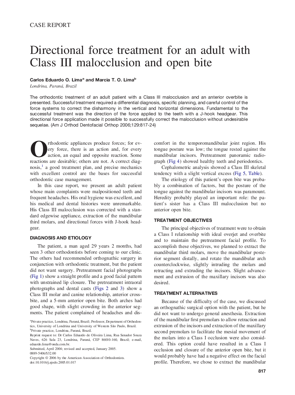 Directional force treatment for an adult with Class III malocclusion and open bite