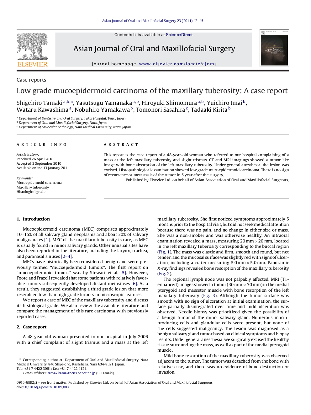 Low grade mucoepidermoid carcinoma of the maxillary tuberosity: A case report