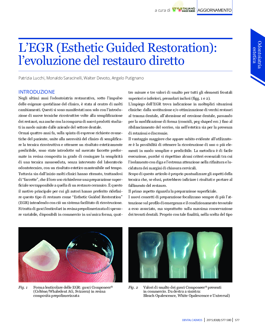 L'EGR (Esthetic Guided Restoration): l'evoluzione del restauro diretto