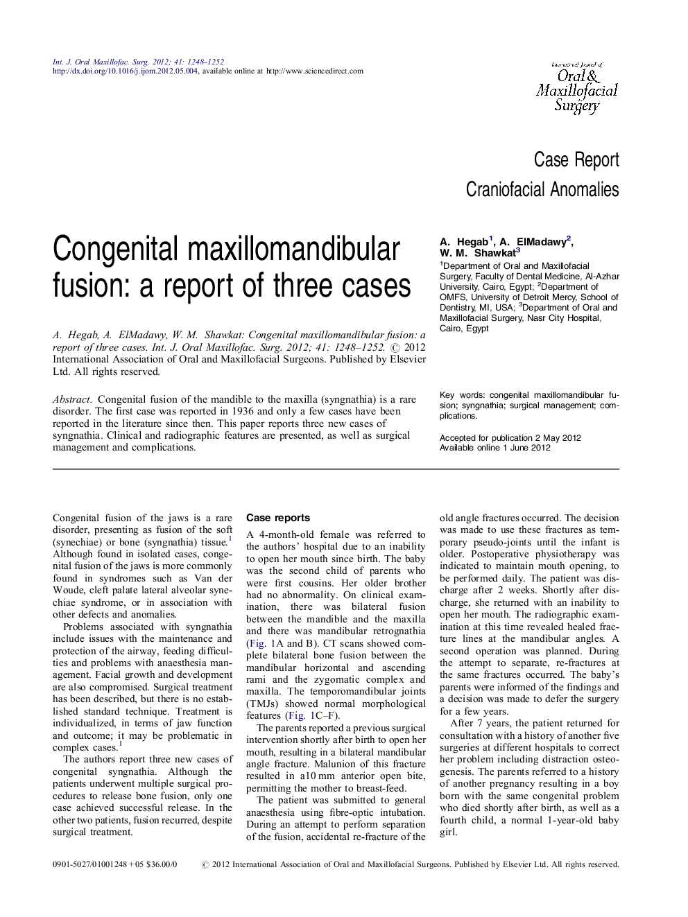 Congenital maxillomandibular fusion: a report of three cases