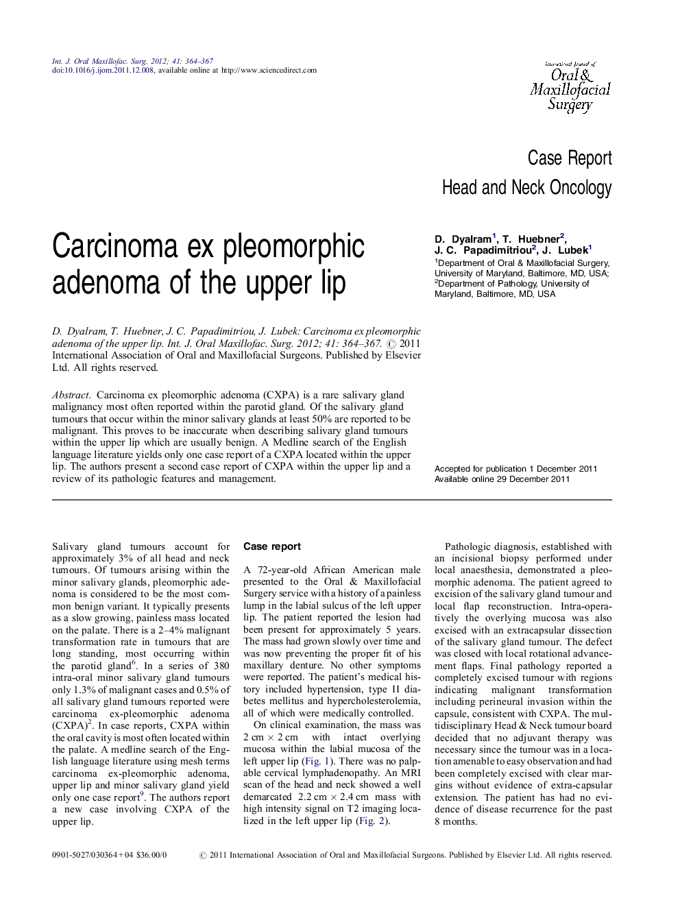 Carcinoma ex pleomorphic adenoma of the upper lip