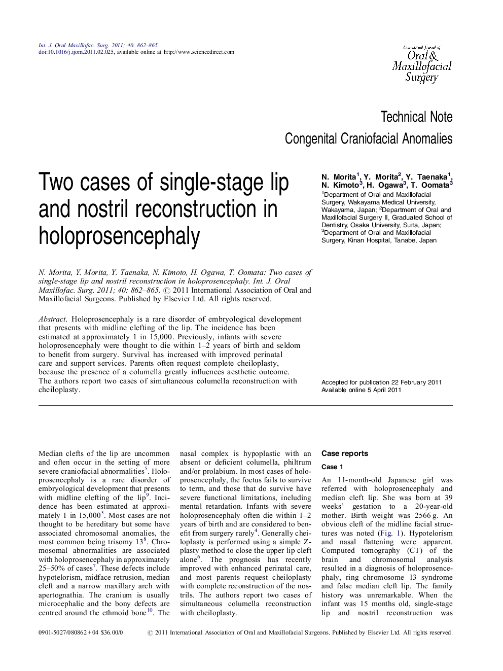 Two cases of single-stage lip and nostril reconstruction in holoprosencephaly