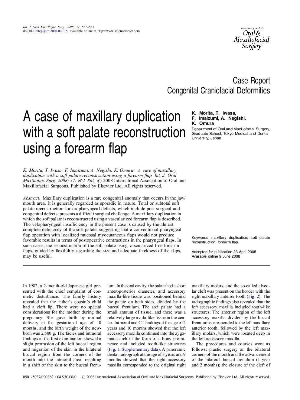 A case of maxillary duplication with a soft palate reconstruction using a forearm flap