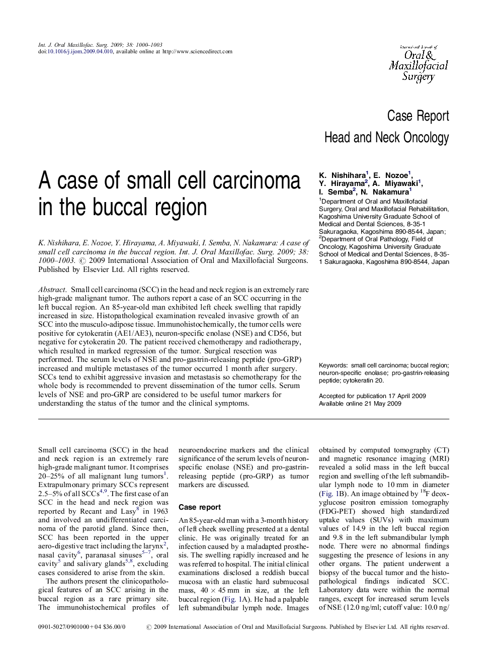 A case of small cell carcinoma in the buccal region