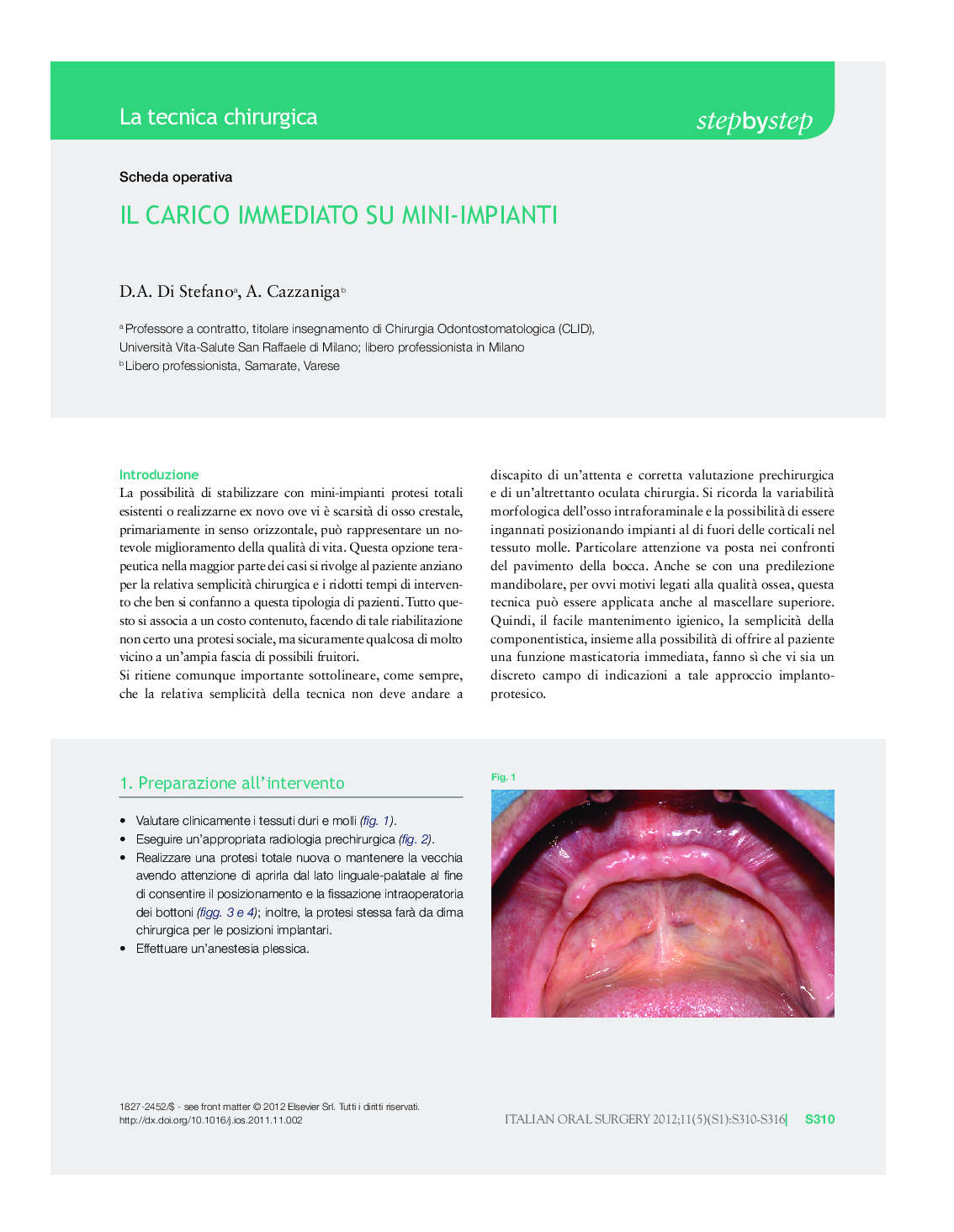 Il carico immediato su mini-impianti