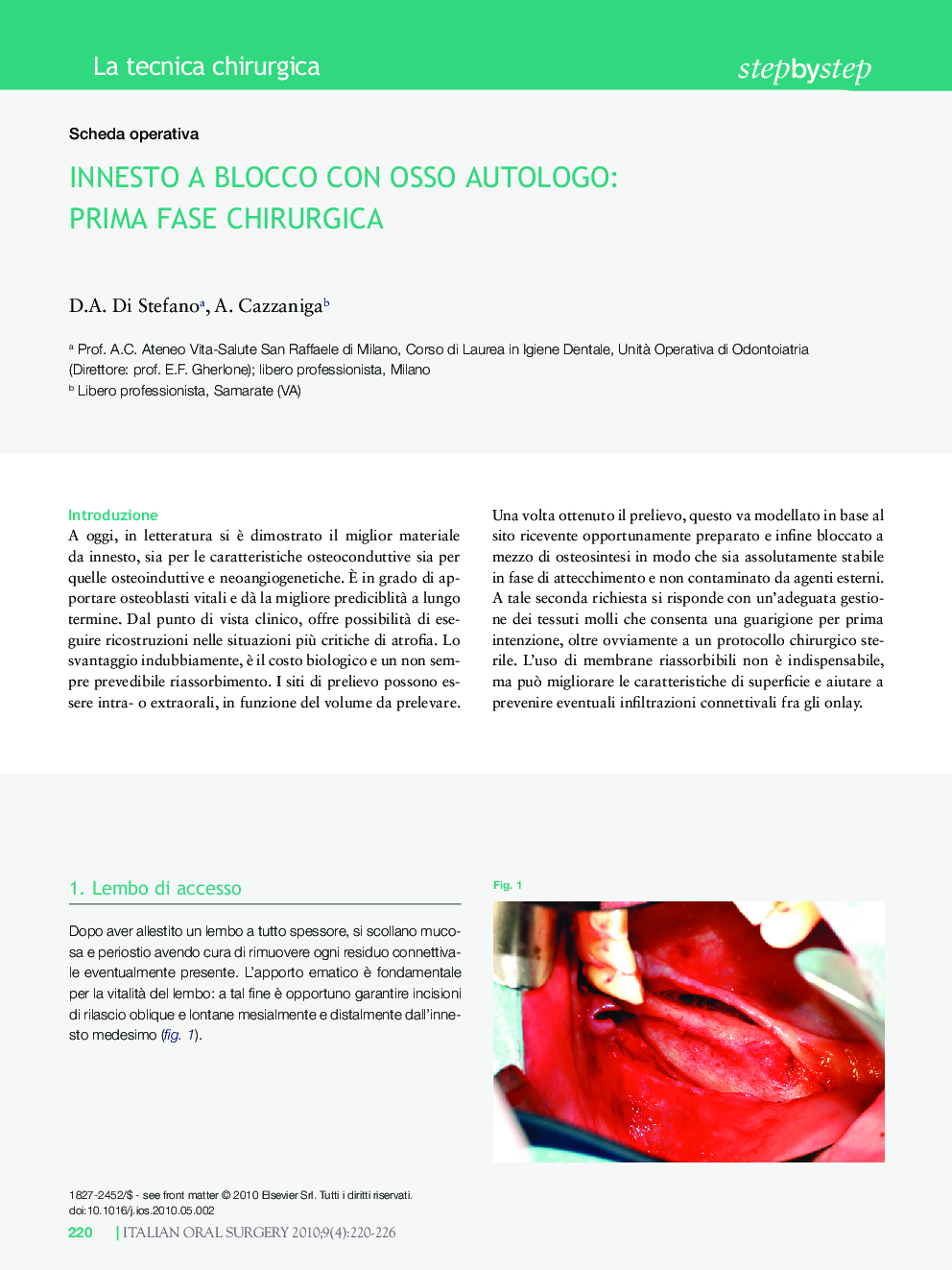 عکس صفحه اول مقاله: Innesto a Blocco Con Osso Autologo: Prima Fase Chirurgica Innesto a Blocco Con Osso Autologo: Prima Fase Chirurgica