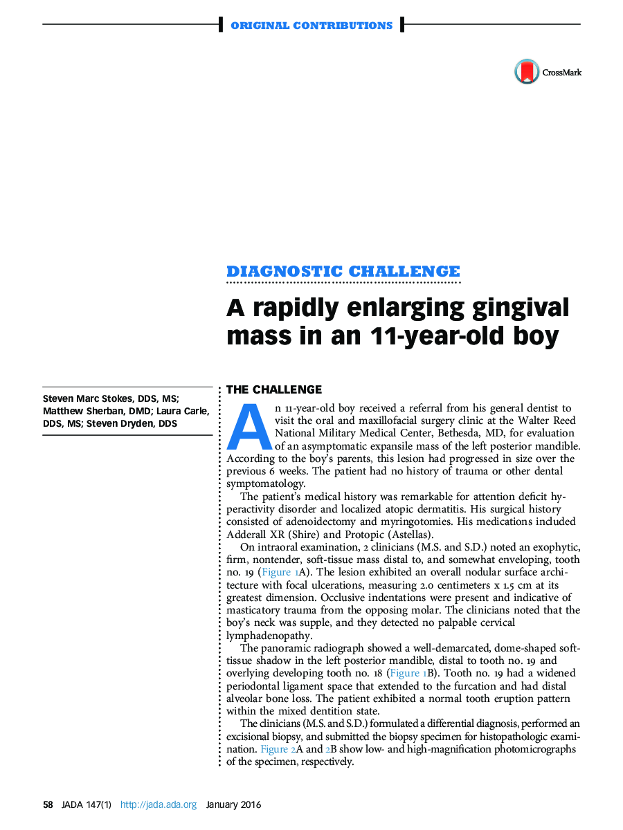 A rapidly enlarging gingival mass in an 11-year-old boy
